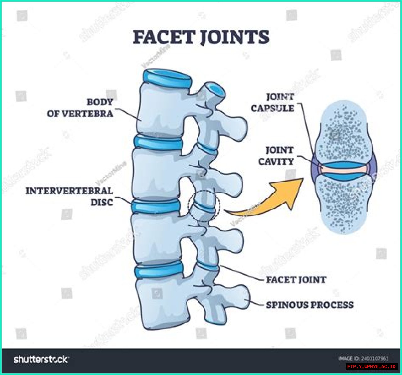 A Comprehensive Guide To Facet Joint Hypertrophy: Definition, Symptoms, And Treatment