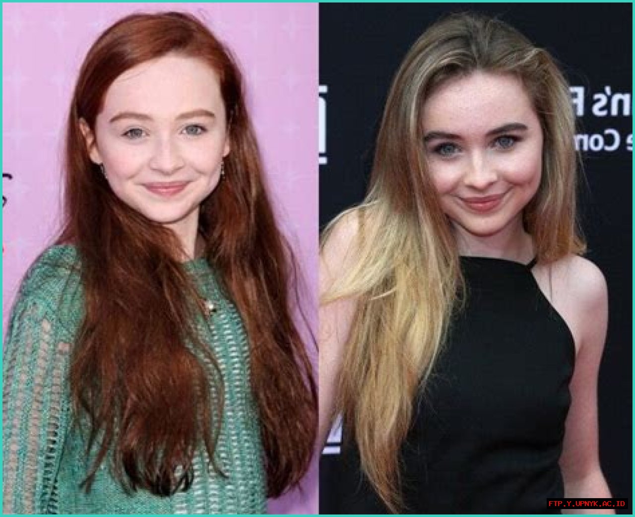 All About Sabrina Carpenter's Lip Fillers: What We Know