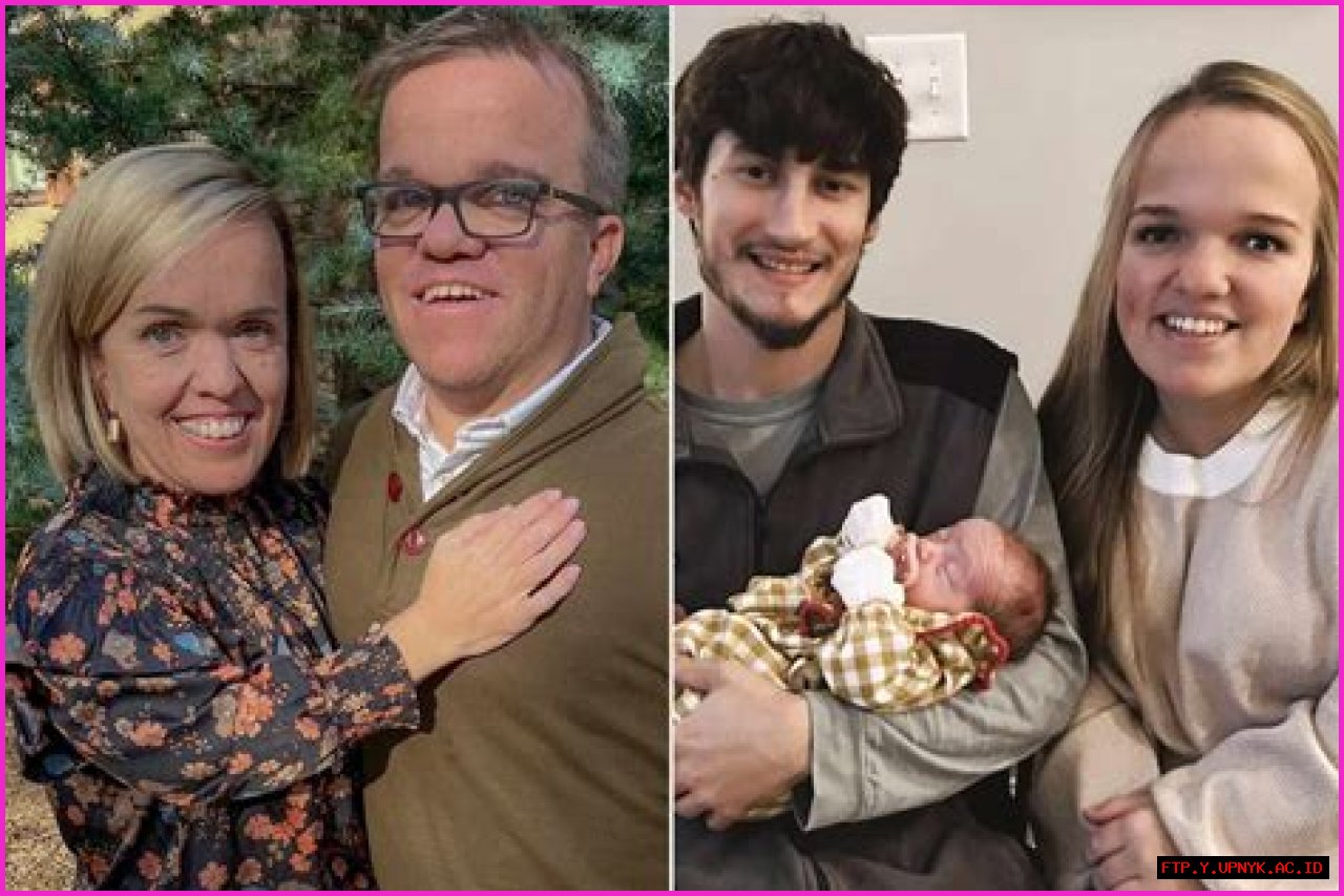 All About The Little Johnston Baby: Unveiling The Truth About Dwarfism