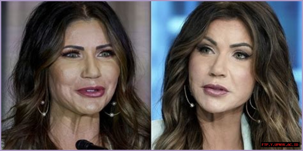 An Unbiased Look At Kristi Noem: Before And After