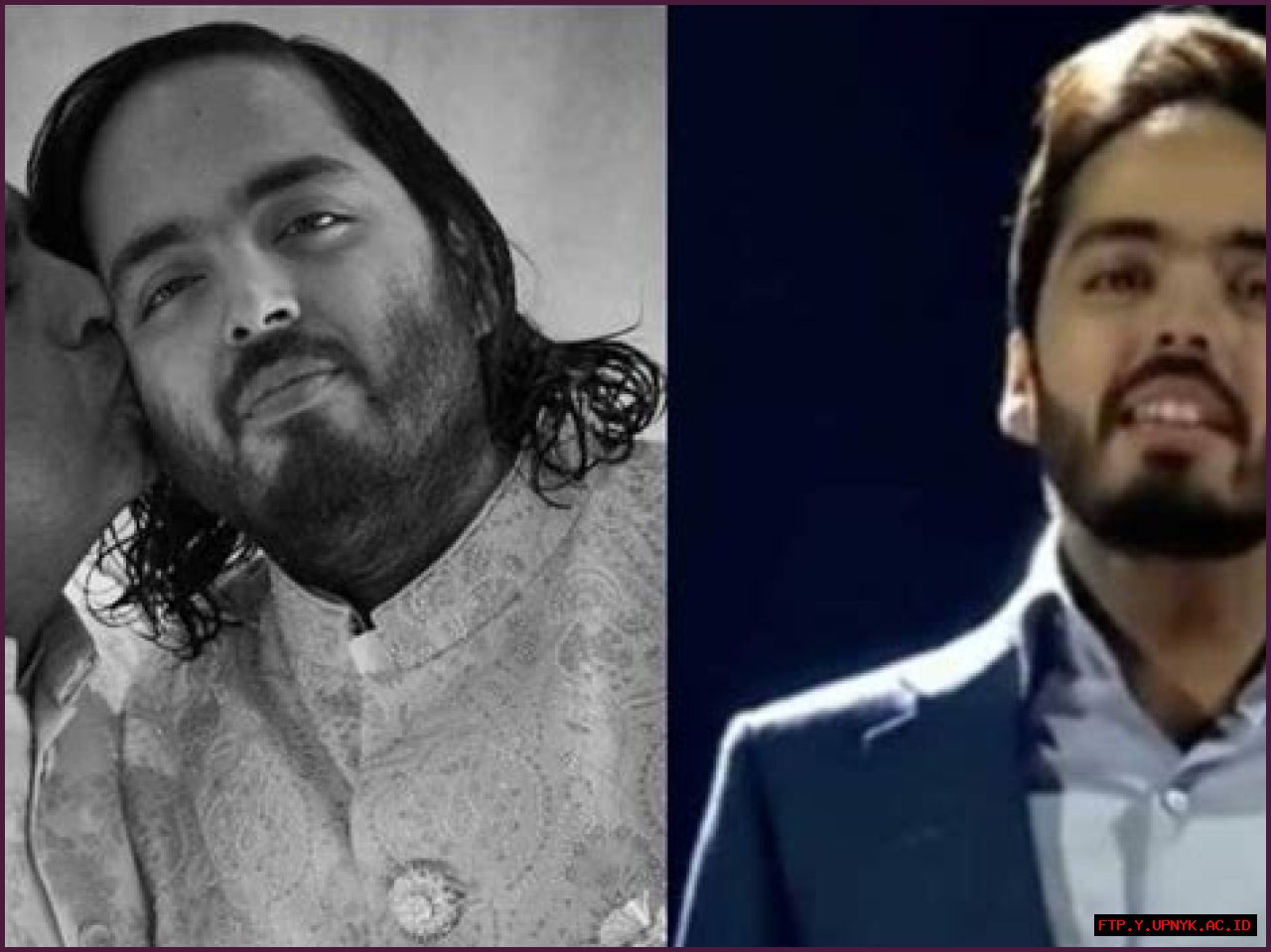 Anant Ambani Health Updates: Get The Latest News On His Recovery