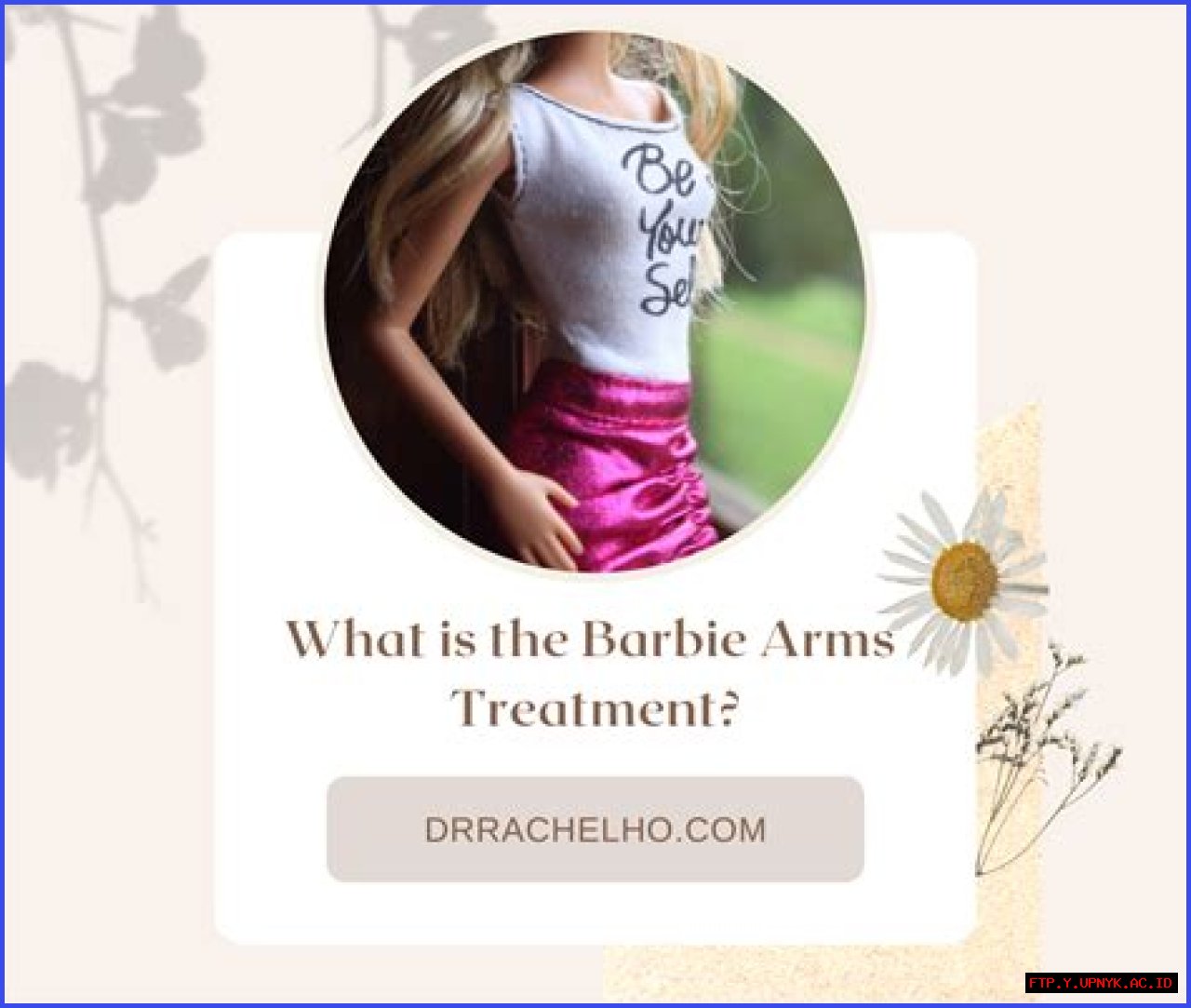 Barbie-like Arms Without Surgery: The Ultimate Guide To Barbie Arm Botox