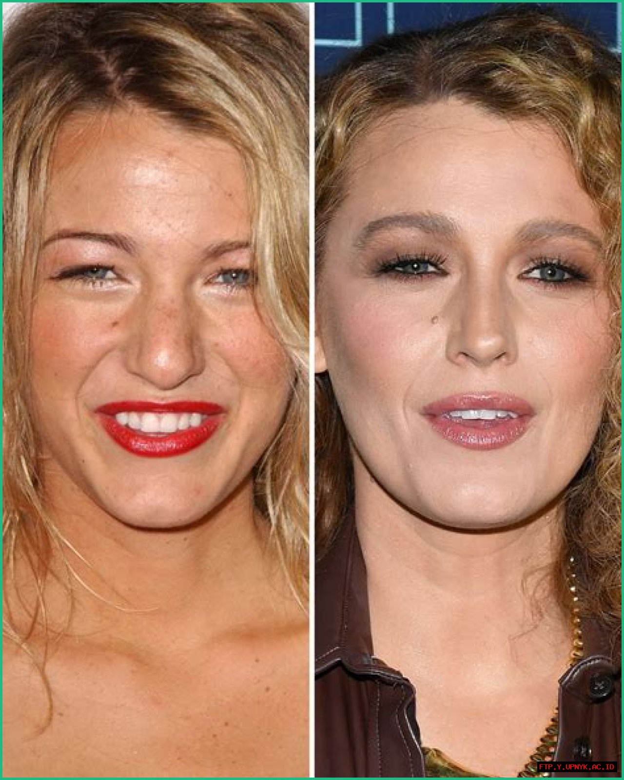 Blake Lively's Transformation: Before And After Her Alleged Nose Job