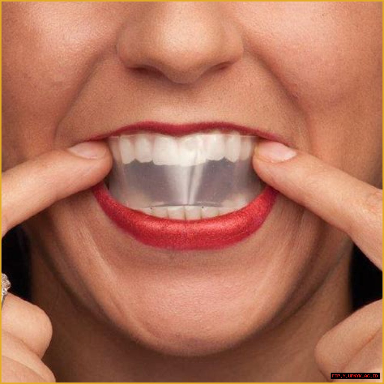 Brilliant Smile With Sheer White Teeth Whitening Strips