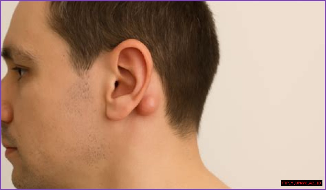 Cillian Murphy's Lump Behind Right Ear: What It Could Mean