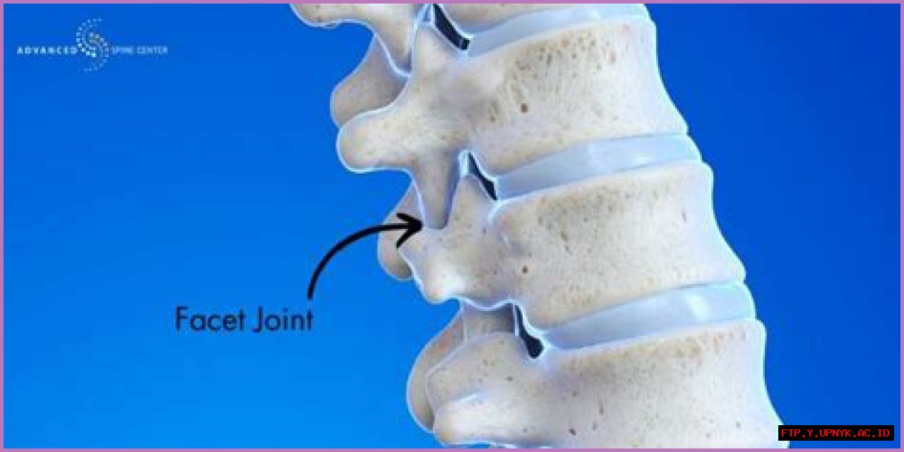 Comprehensive Guide To Facet Hypertrophy: Definition And Beyond