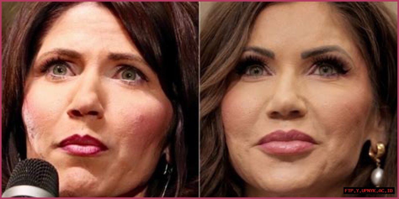 Cosmetic Surgery Transformation: Unveiling Kristi Noem's Before And After