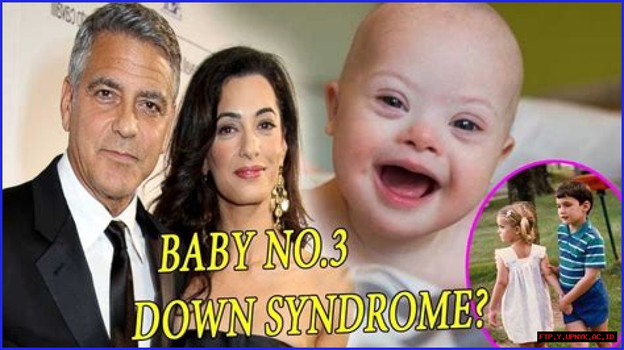 Could One Of George Clooney's Twins Have Down Syndrome?