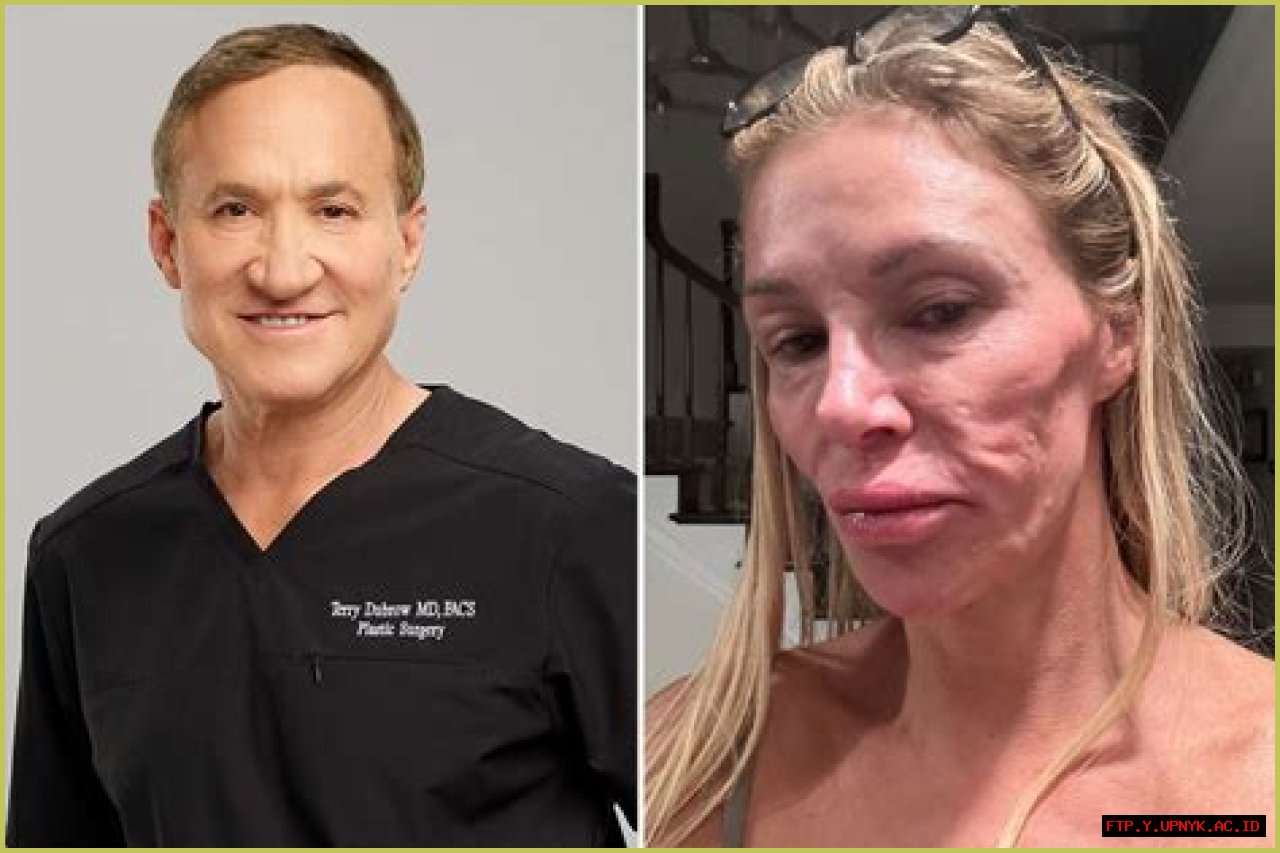 Discover The Secrets Of Plastic Surgery Pioneers: Kevin And Terry Dubrow