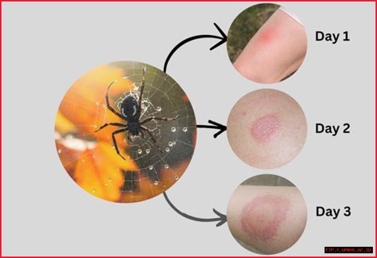Discover The Secrets: Unveiling Signs Of Spider Pregnancy