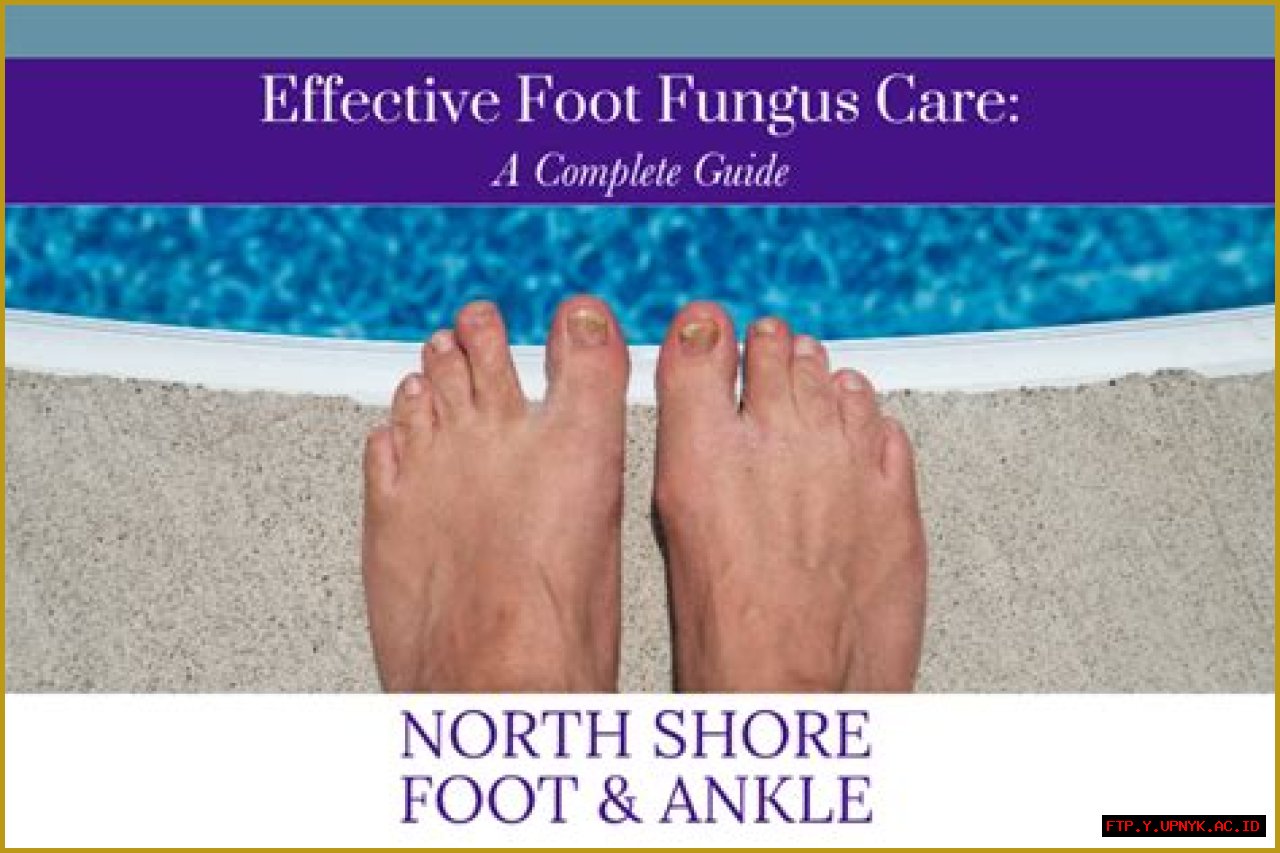 Effective Foot Fungus Commercial: Treat Your Infection Today