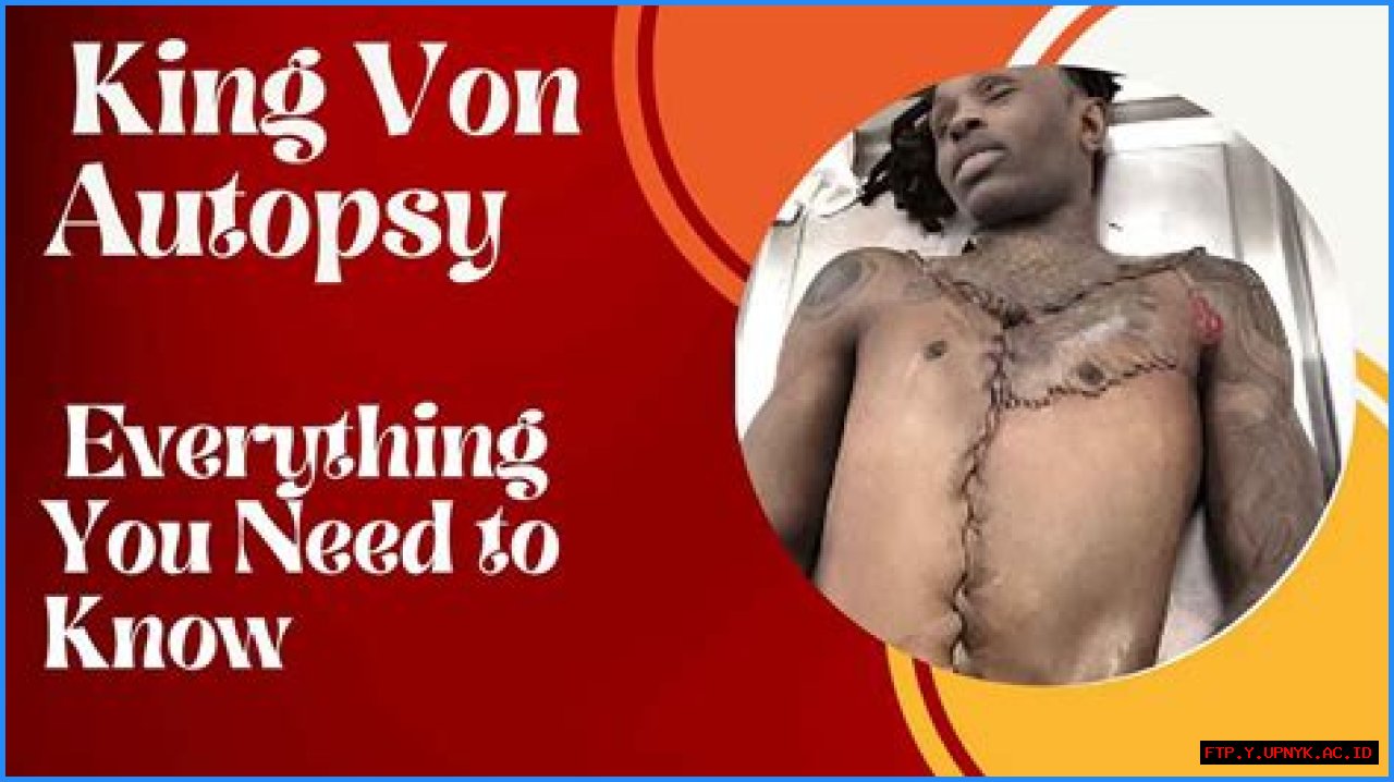 Exploring The Life And Legacy Of King Von: A Deep Dive Into His Autopsy