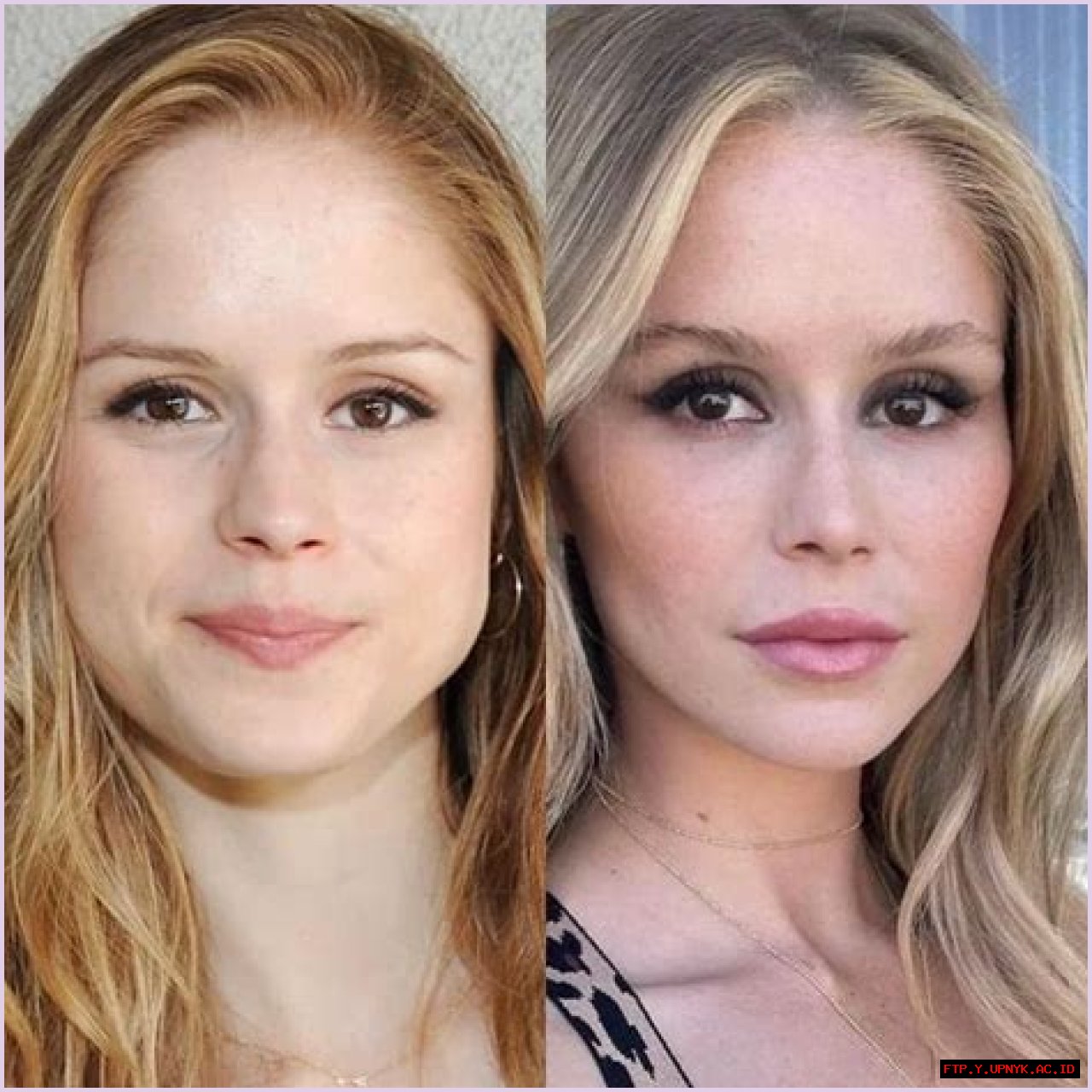 Exploring The World Of Plastic Surgery Comparison: A Deep Dive