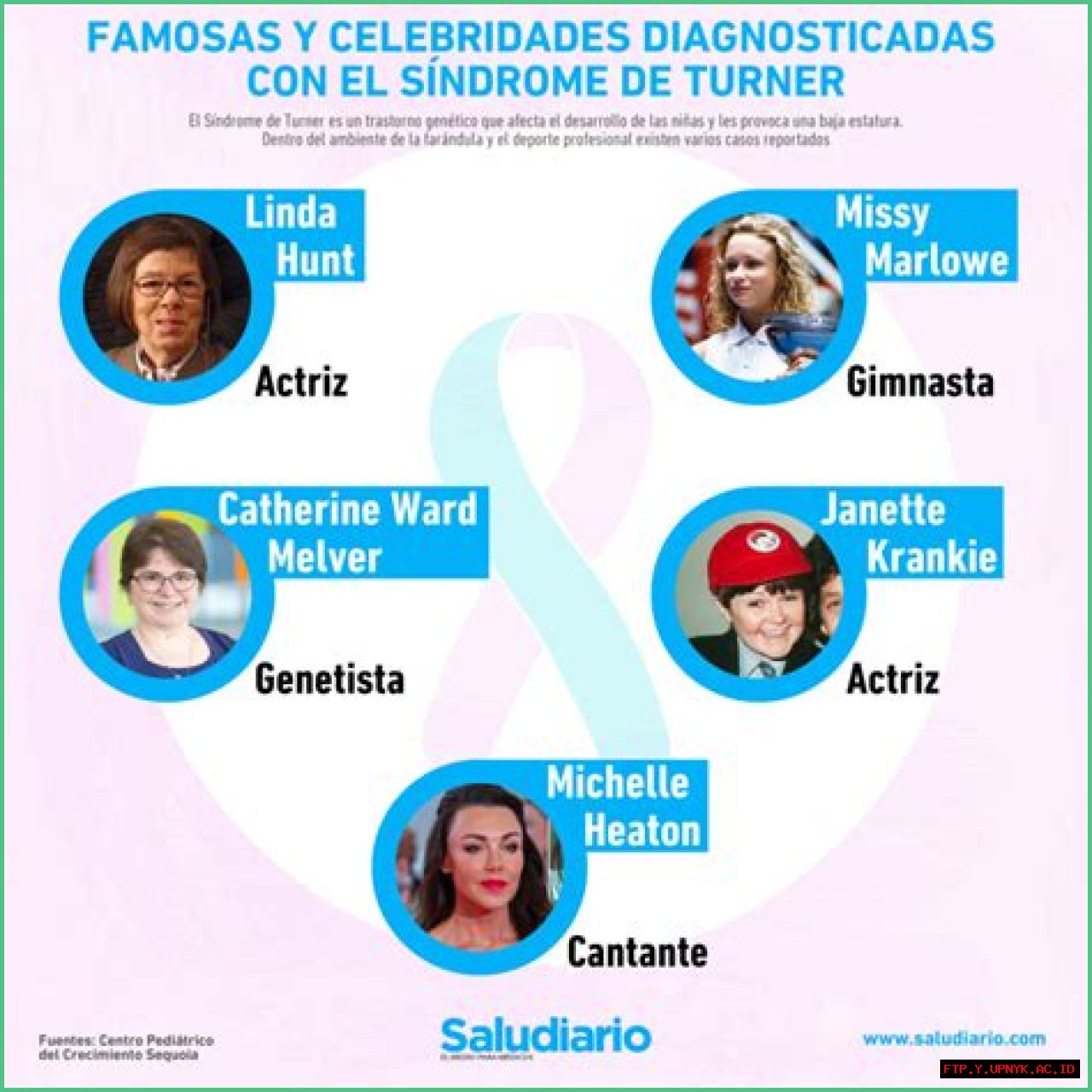 Fascinating Turner Syndrome Celebrities: Uncovering Their Stories And Impact