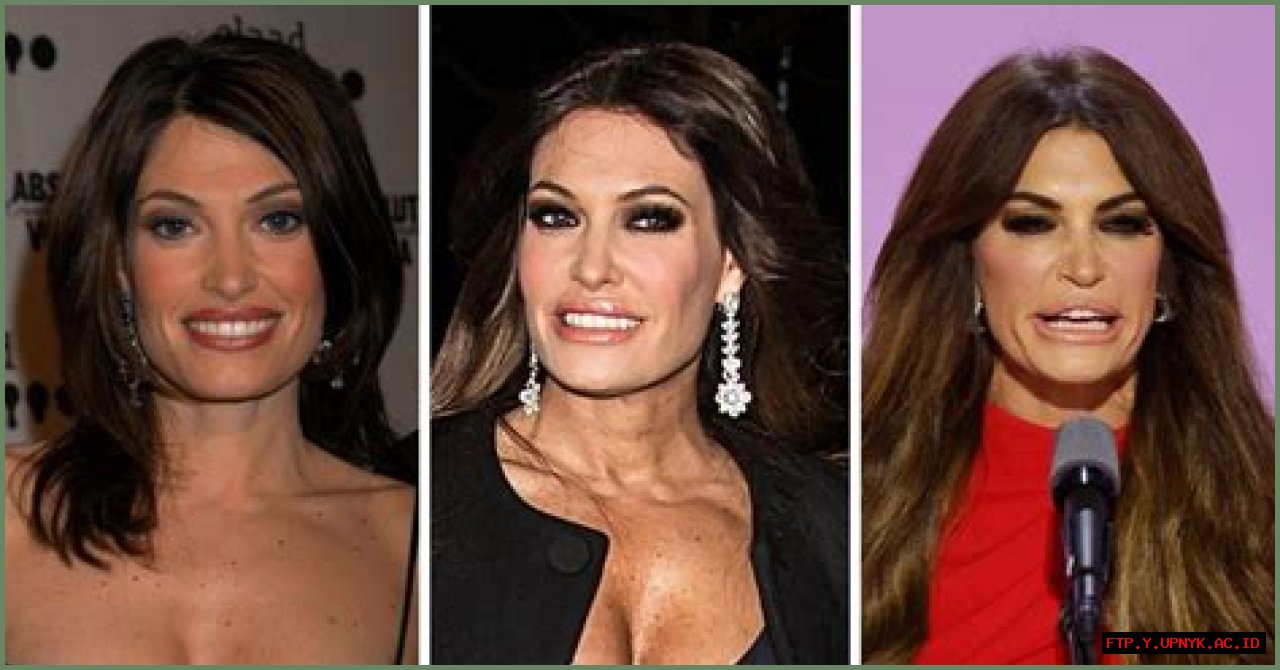 Has Kimberly Guilfoyle's Plastic Surgery Transformed Her Appearance?
