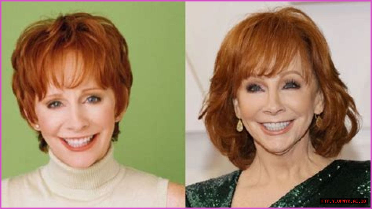 Has Reba McEntire's Facelift Left Her Looking Younger Or Stretched?