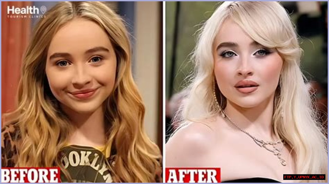 Has Sabrina Carpenter Undergone Plastic Surgery? Unraveling The Truth