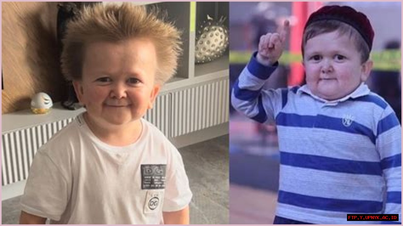 Hasbulla's Disability: A Unique Perspective On Life