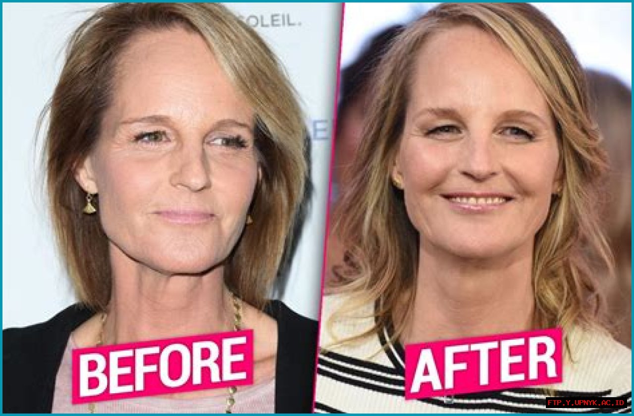 Helen Hunt's Facelift Transformation: A Guide To Her Rejuvenated Look