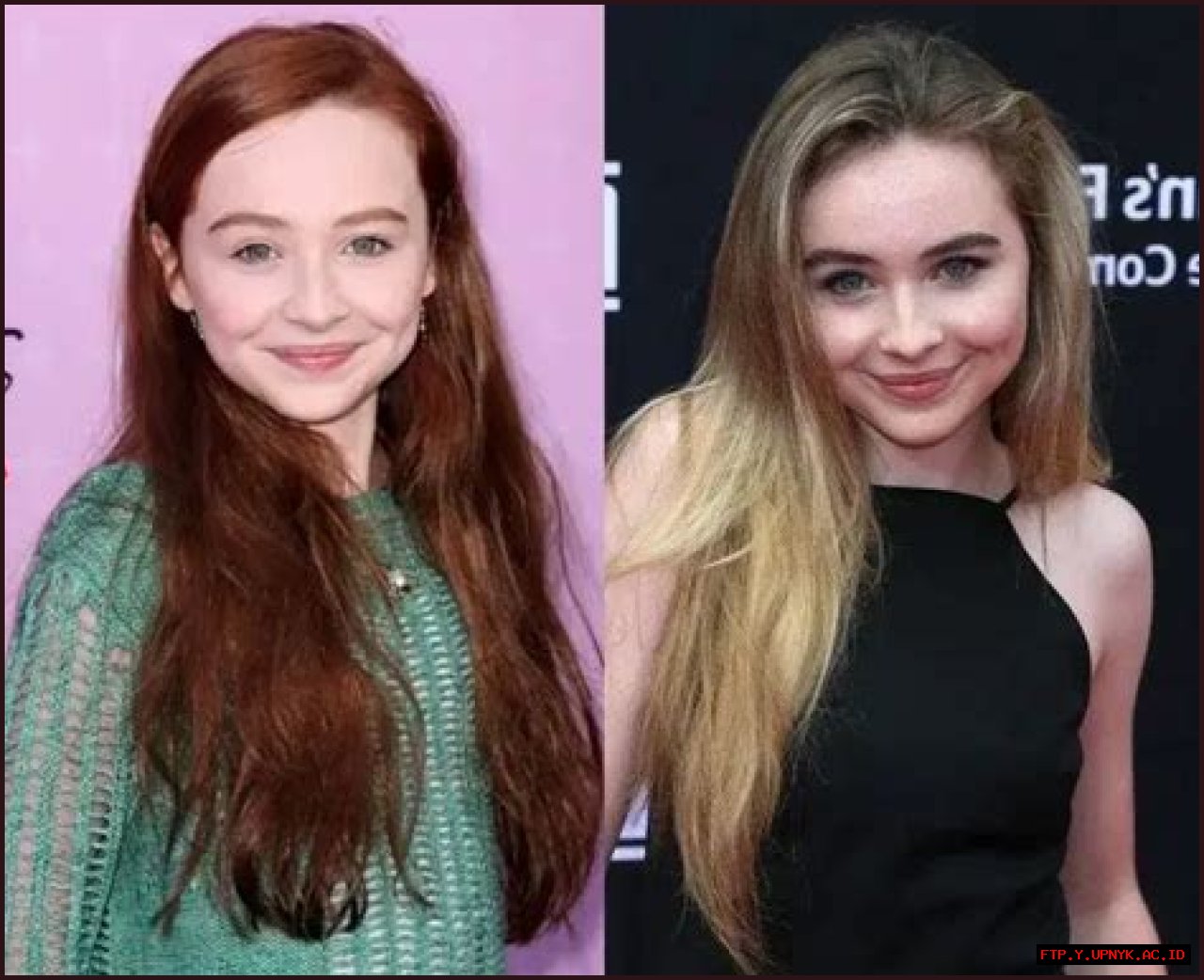 Inside The Transformation: Sabrina Carpenter's Plastic Surgery Journey