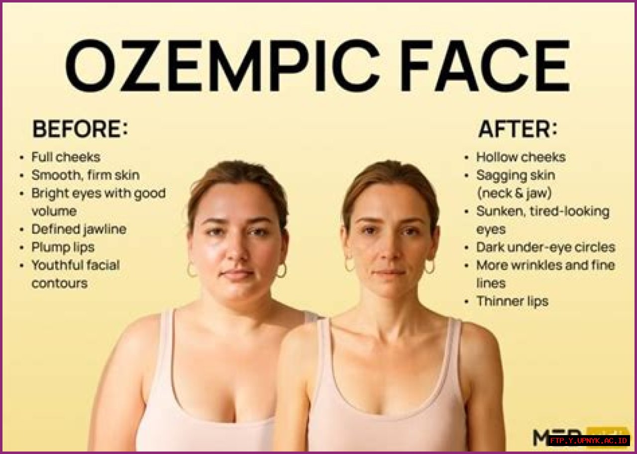 Introducing Ozempic: A Solution For Dry Eyes Caused By Ozempic