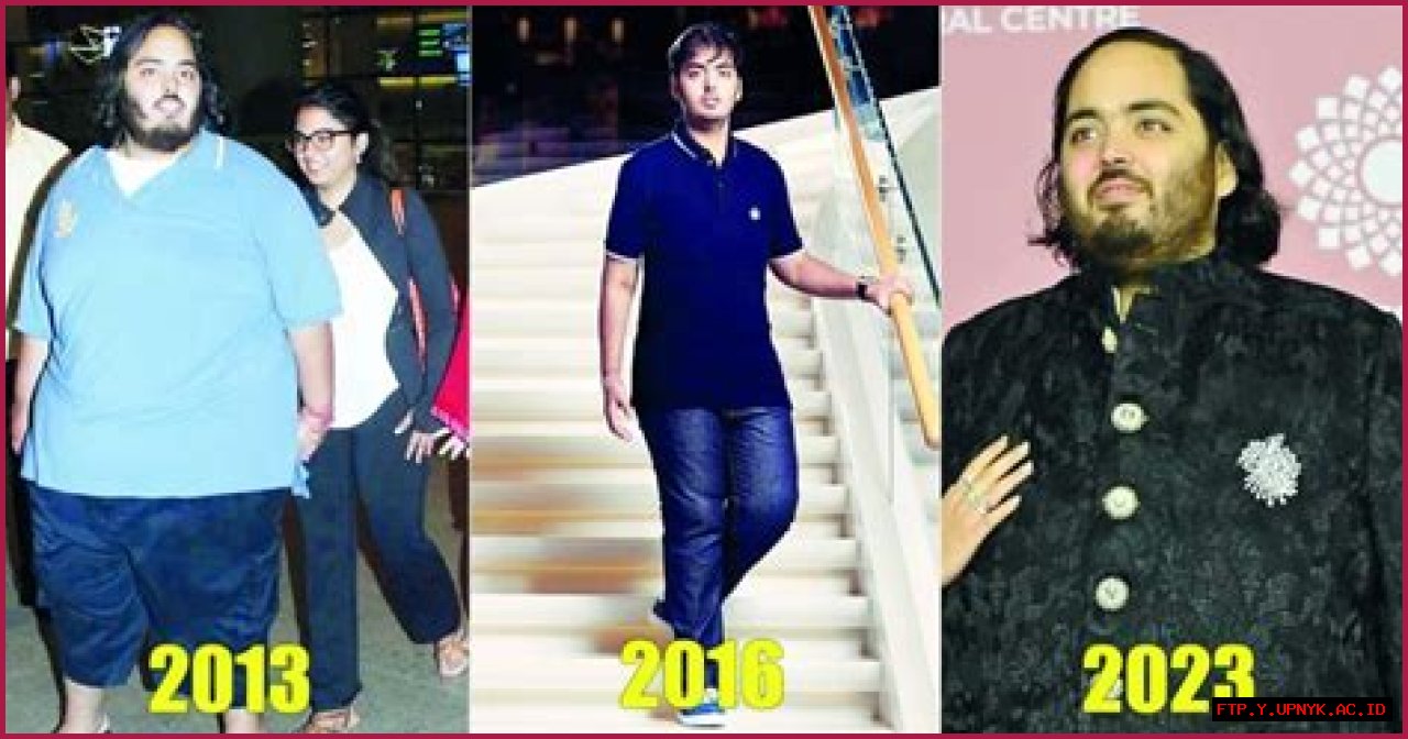 Is Anant Ambani Physically Disabled? Answering The Rumors