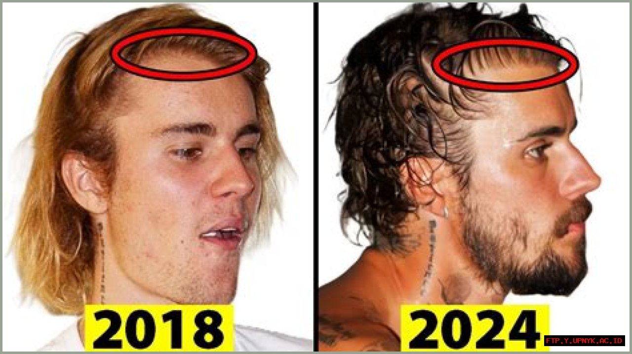 Justin Bieber's Weight Loss Transformation: A Timeline Of His Journey