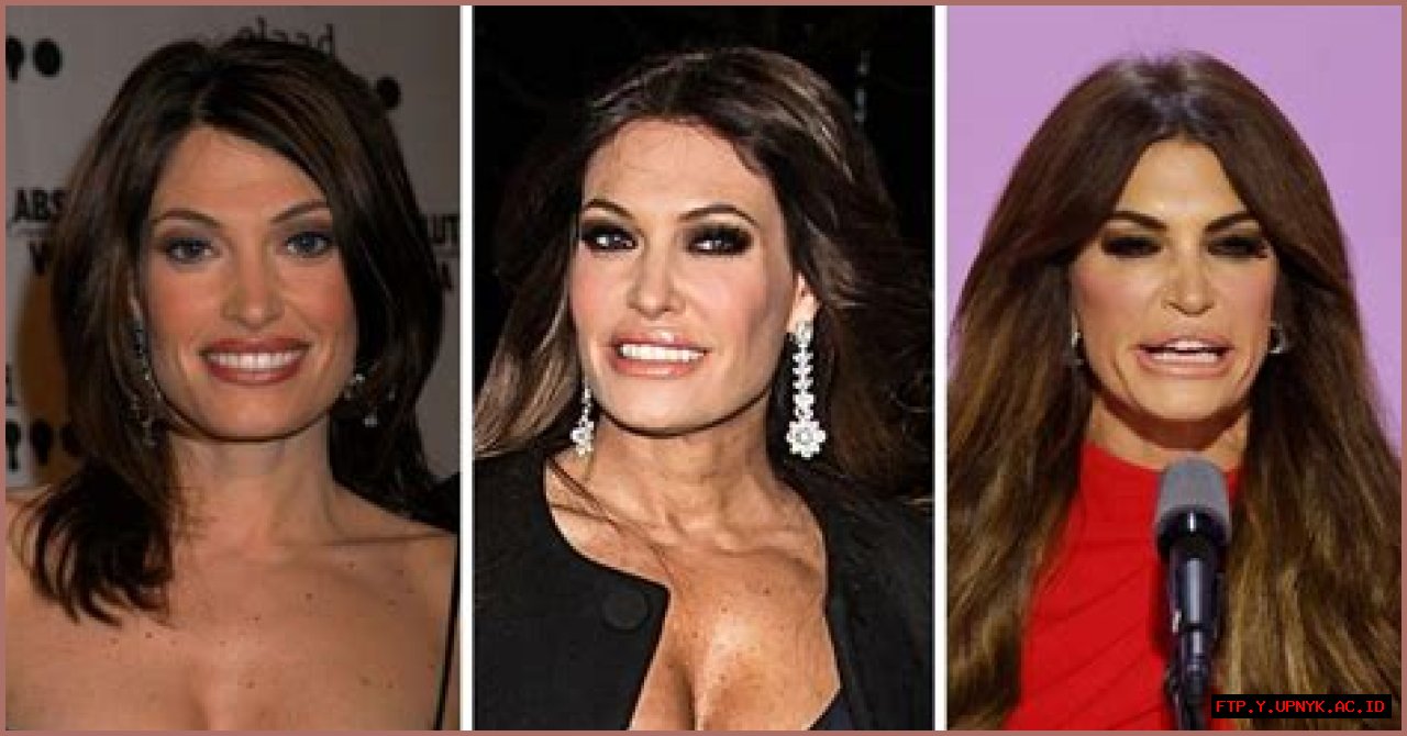 Kimberly Guilfoyle's Plastic Surgery Transformation: A Visual Journey