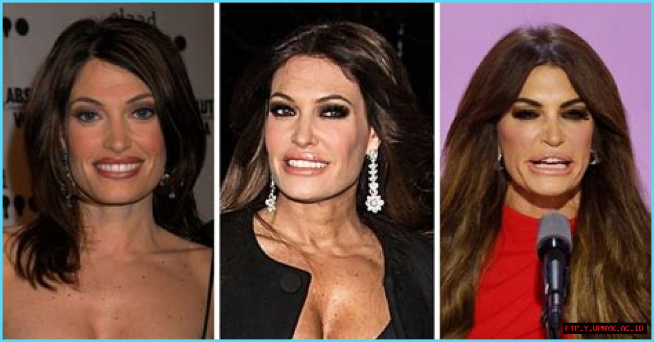 Kimberly Guilfoyle's Stunning Face Lift Transformation | Before And After