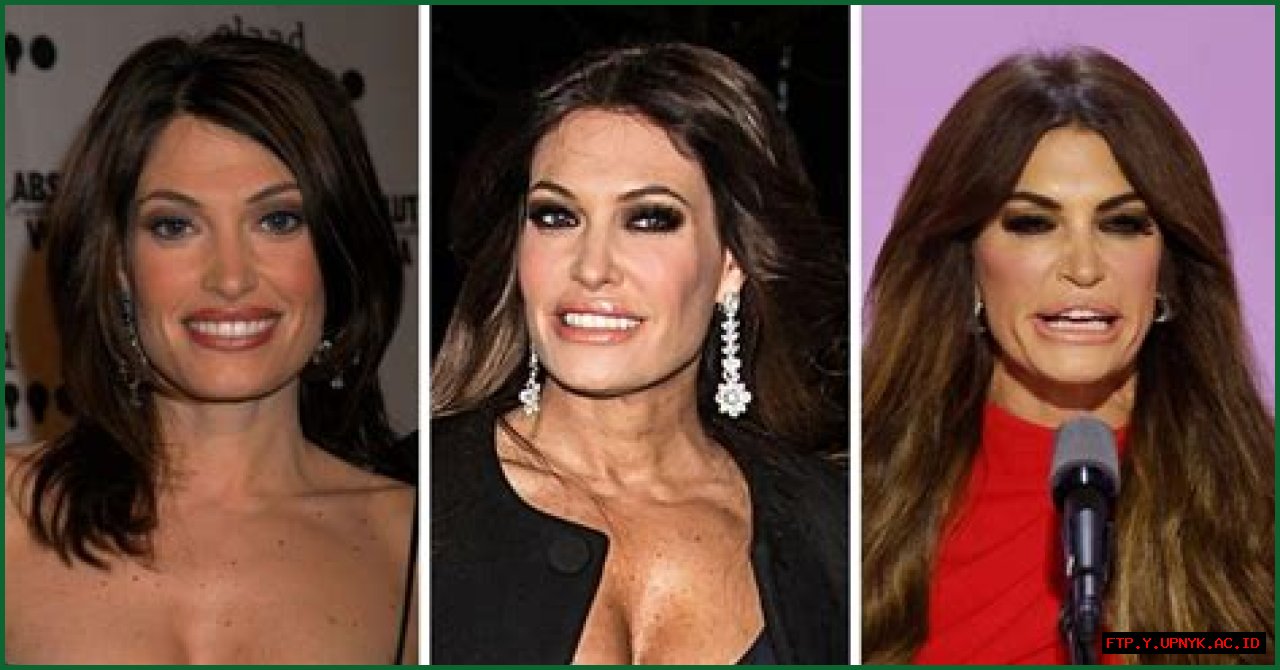 Kimberly Guilfoyle's Transformation: Before And After Photos