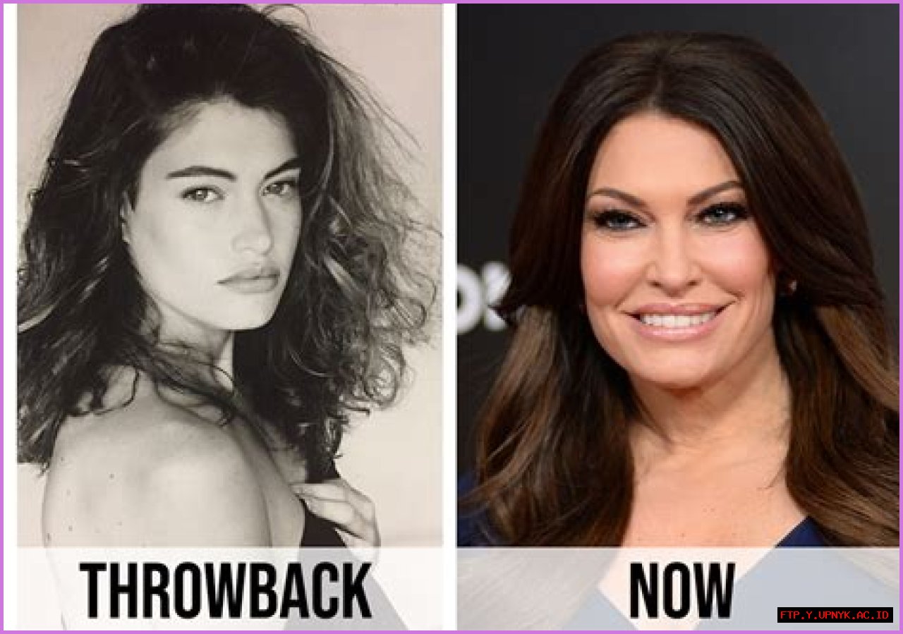 Kimberly Guilfoyle's Transformation: Before And After Plastic Surgery