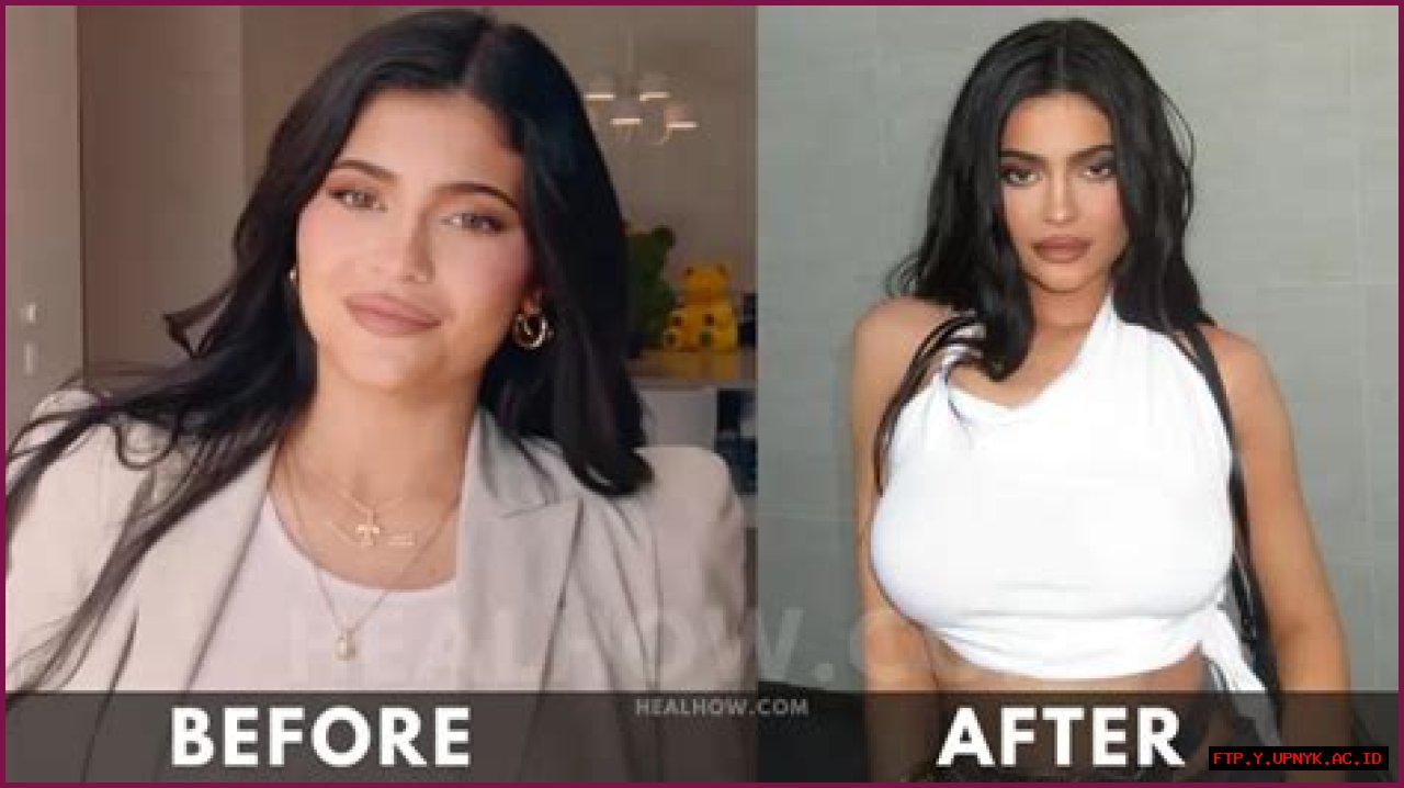 Kylie Jenner's Surprising Weight Loss Journey