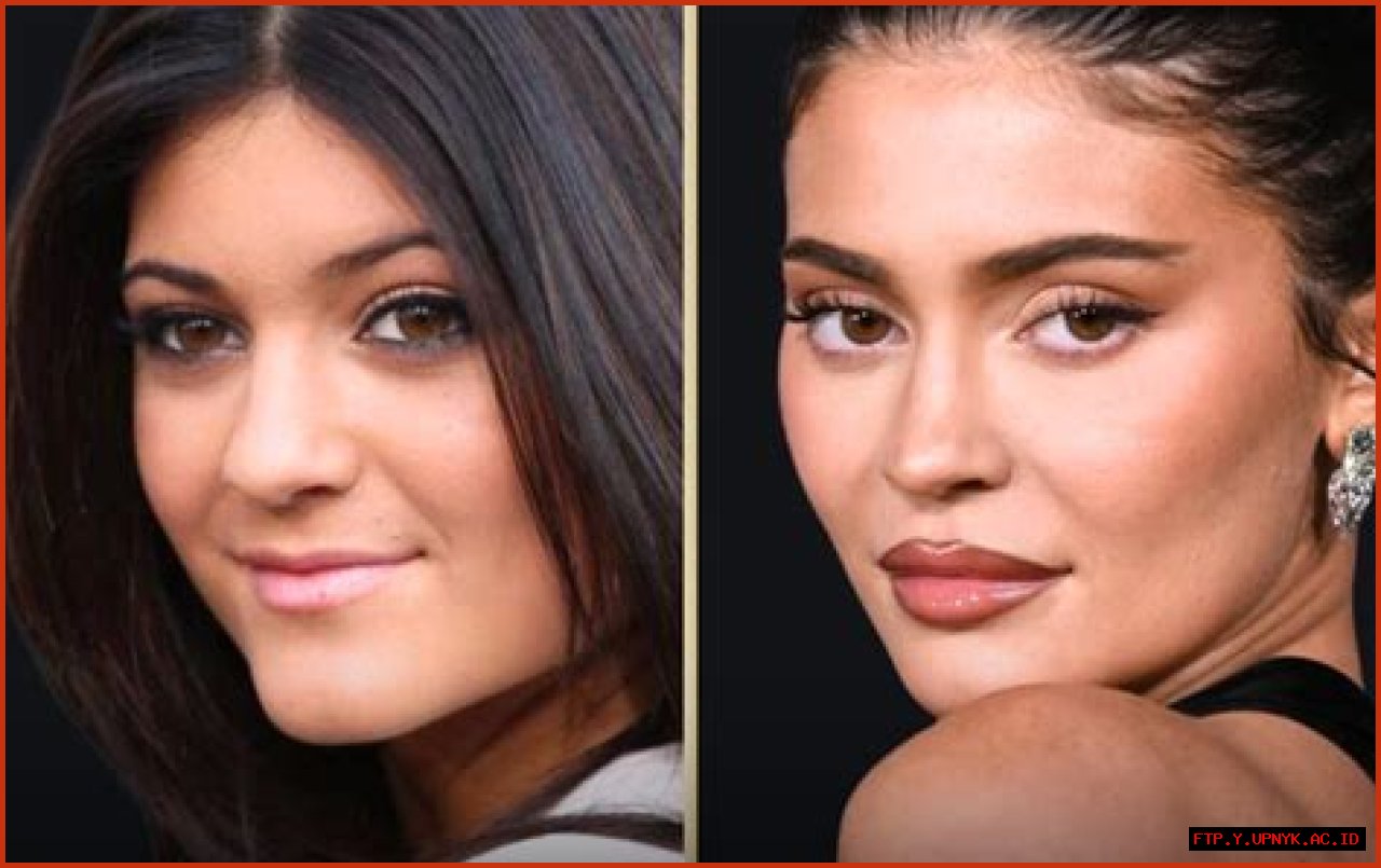 Kylie Jenner's Weight Gain: Is She Really 'Fat'?