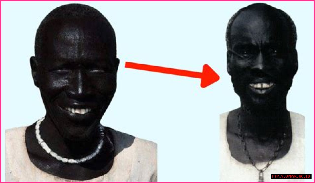 Meet The Darkest Man Alive: A True Story Of Melanin And Medical Marvels