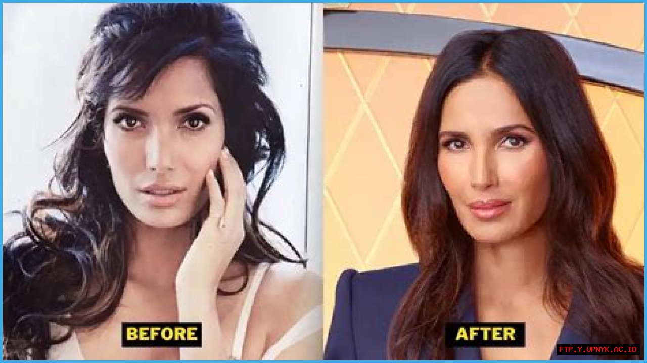 Padma Lakshmi Surgery: All You Need To Know