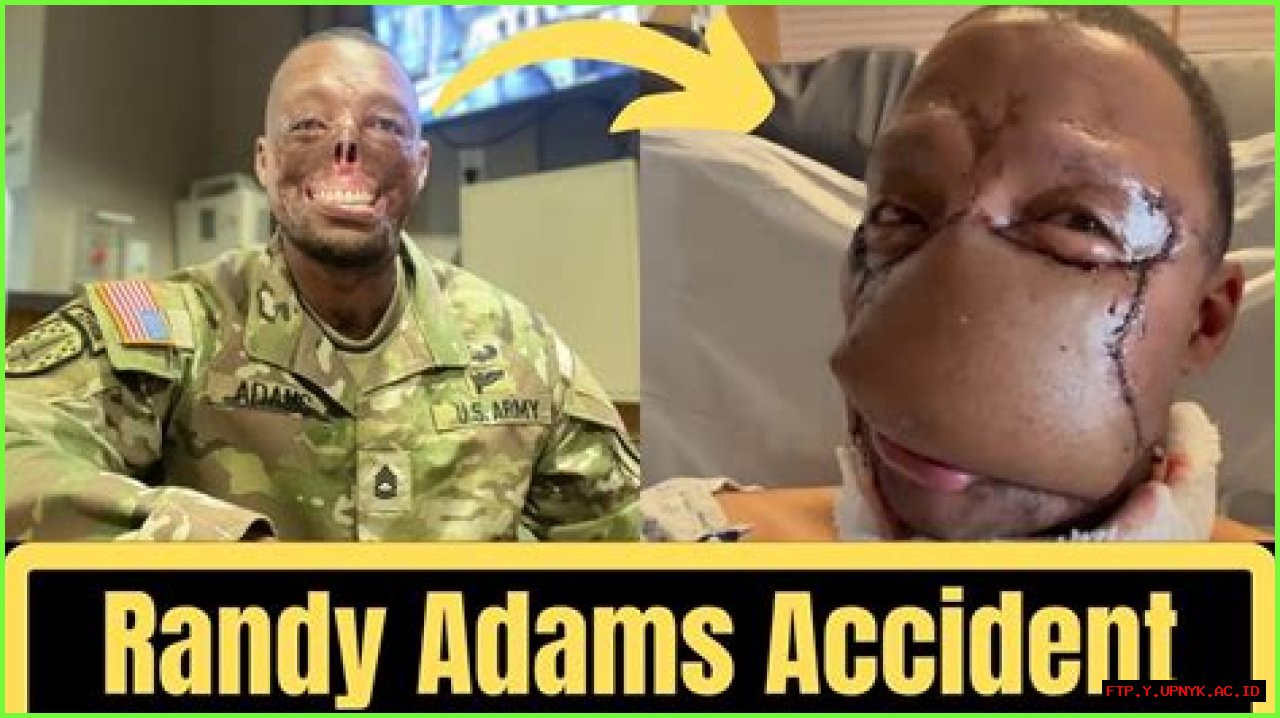 Randy Adams | Face Aftermath | Accident Injuries