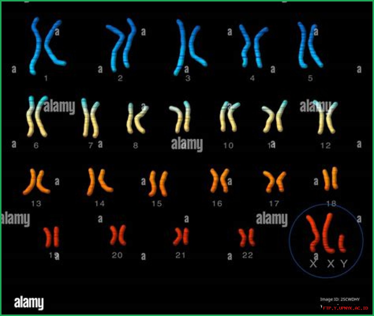 Recognized Individuals With XXY: Notable Figures With XYY Syndrome
