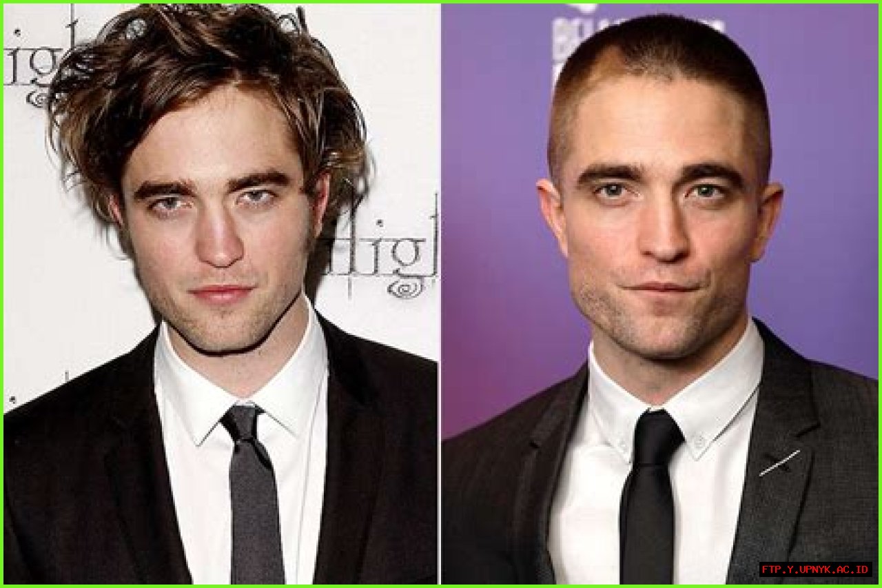 Robert Pattinson's Hairline: The Evolution Through The Years