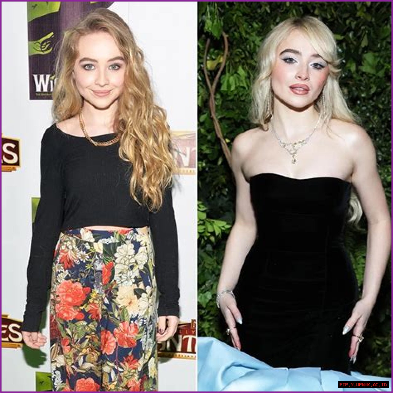 Sabrina Carpenter Before And After Nose Job: A Transformation Explored