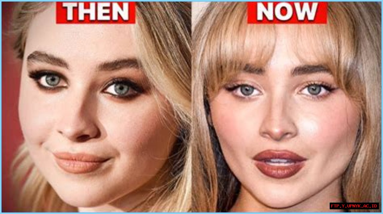 Sabrina Carpenter: Uncovering The Truth About Her Before And After Surgery