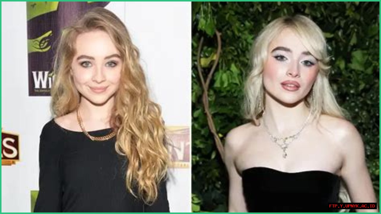 Sabrina Carpenter's Journey With Botox: A Comprehensive Guide