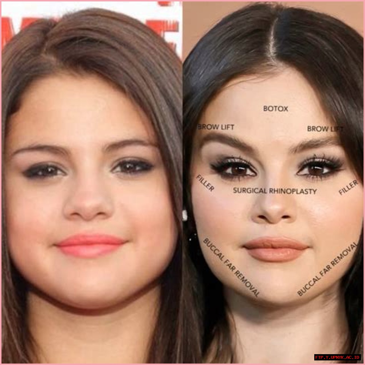 Selena Gomez's Cheeks: A Guide To Her Iconic Look