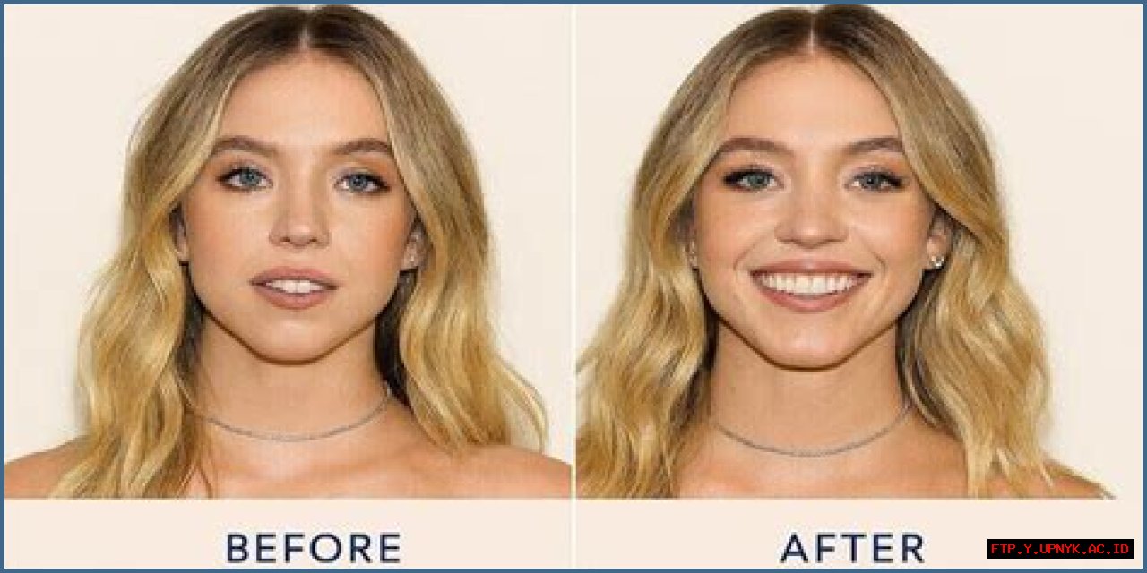 Sydney Sweeney Plastic Surgery: What You Need To Know