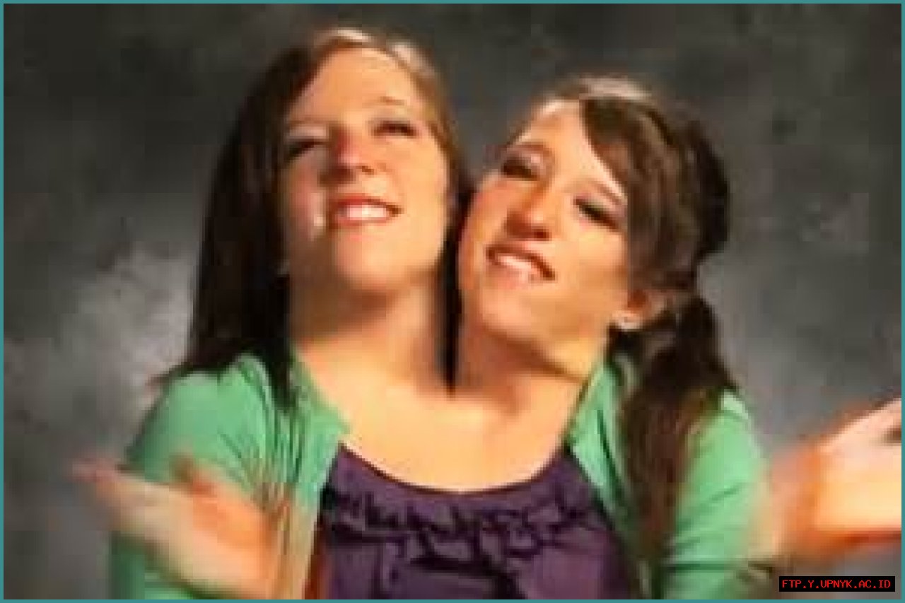 The Extraordinary Tale Of Conjoined Twins: Abby And Brittany Hensel