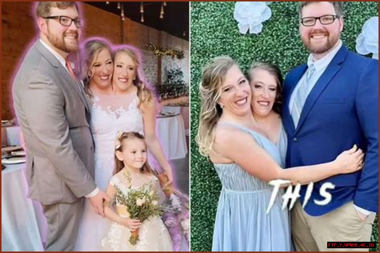 The Heartbreaking Family Tragedy Of Abby And Brittany Hensel: A Life Lived In Two Bodies