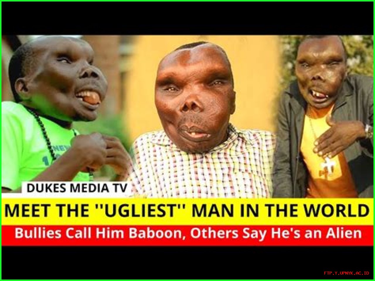 The Surprising Truth About Being Dubbed The Ugliest Person In The World