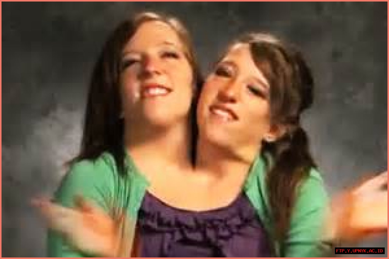 The Tragic Fate Of Conjoined Twins: Abby And Brittany Hensel