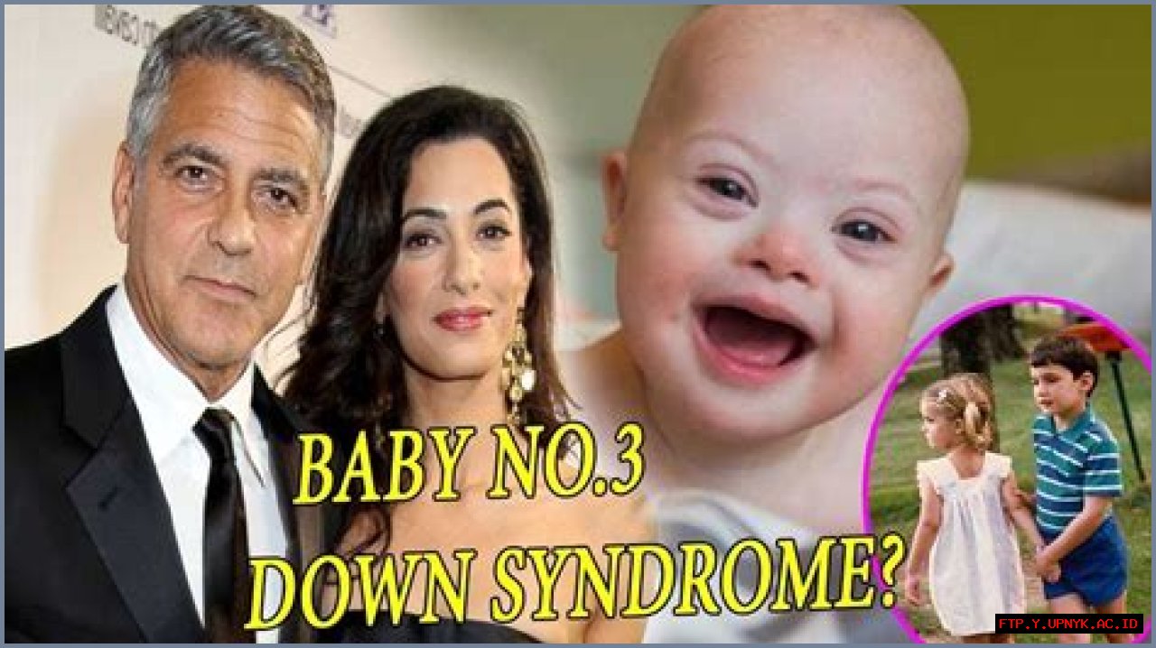 The Tragic Truth: George Clooney's Twin Down Syndrome