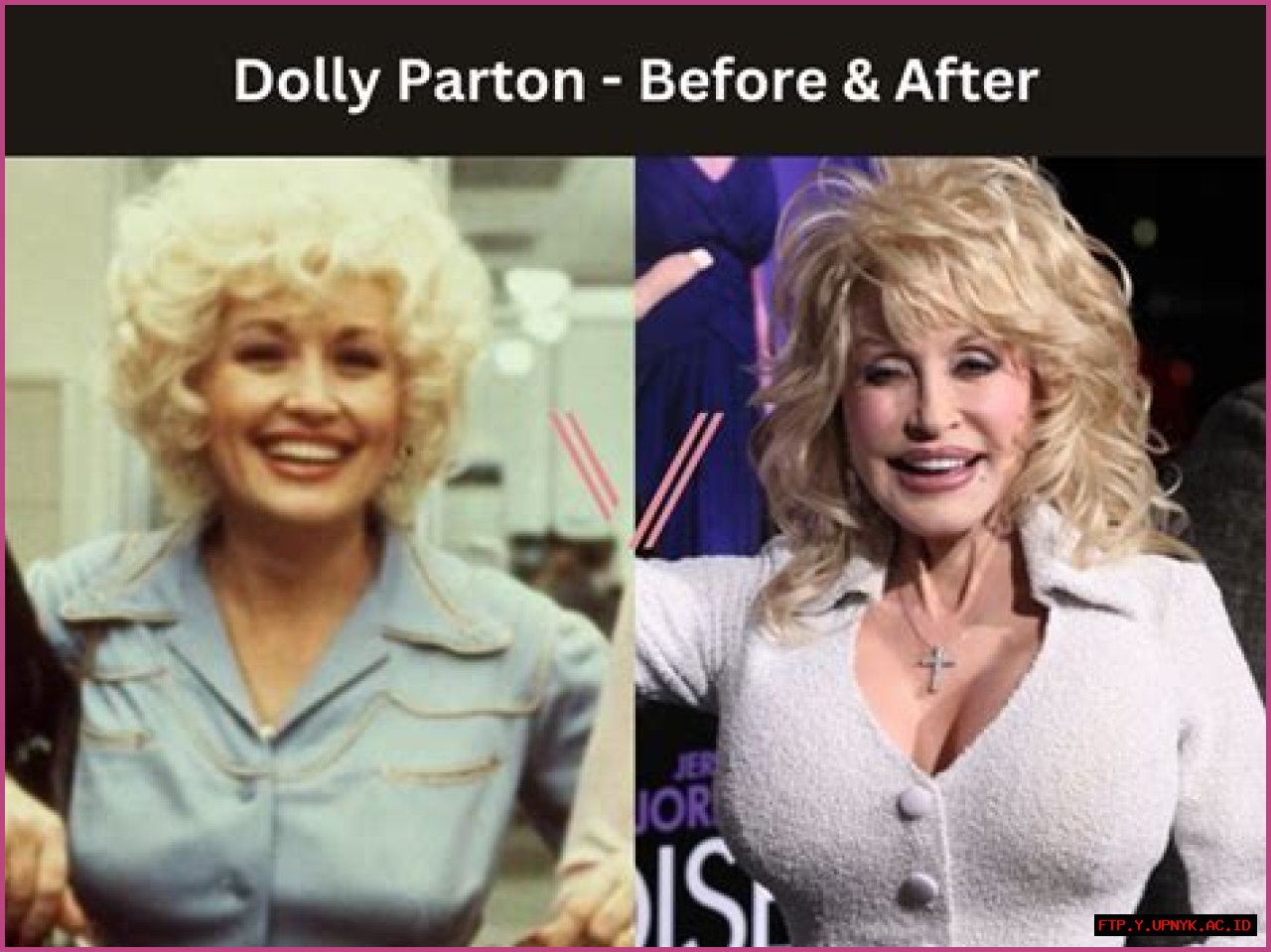 The Truth About Dolly Parton's Bust: Are They Real Or Enhanced?