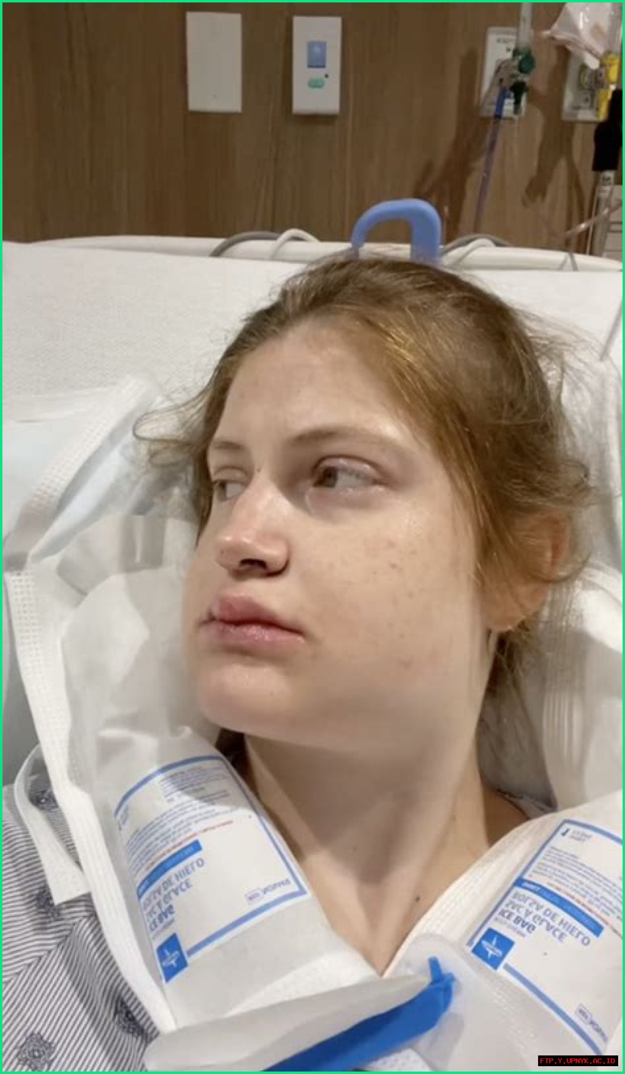 The Ugly Truth: Double Jaw Surgery Gone Horribly Wrong